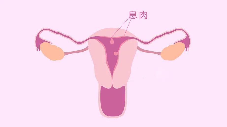 开发区医院官网(开发区医院),子宫内膜异位症