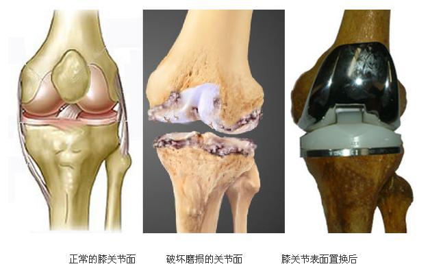 开发区医院官网(开发区医院),人工关节置换